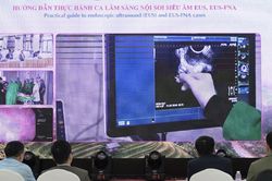 Ung thư đại trực tràng tăng nhanh, có bệnh nhân mới 14 tuổi đã mắc