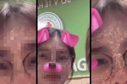 Sinh viên y khoa dọa 'tiêm thuốc độc', nhà trường và bệnh viện chịu trách nhiệm gì?