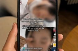 Trường Đại học Y H&agrave; Nội l&ecirc;n tiếng việc sinh vi&ecirc;n 'dọa' sẽ lấy trật ven bệnh nh&acirc;n