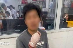 Cảnh sát giao thông dẫn đường cho nạn nhân bị tai nạn đứt 4 ngón tay đi cấp cứu