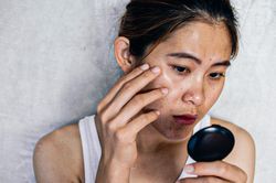 5 thói quen hằng ngày âm thầm khiến làn da dễ bị nám, nhiều người vẫn lặp lại mà không hay biết