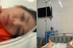 Sản phụ liệt 2 ch&acirc;n sau giảm đau sinh mổ, Bệnh viện n&oacute;i g&igrave;?