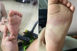 Xác minh thông tin bé trai 3 tuổi nghi bị giáo viên bạo hành ở Hưng Yên