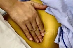 Ch&acirc;u &Acirc;u kh&oacute; đạt mục ti&ecirc;u loại trừ vi&ecirc;m gan virus v&agrave;o năm 2030