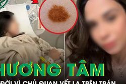 Cô gái 26 tuổi qua đời thương tâm vì chủ quan vết lạ trên trán