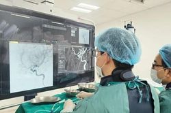 Đau đầu kéo dài cảnh giác với túi phình động mạch não nguy hiểm