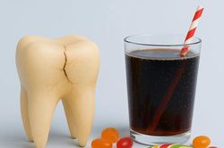 Nước ngọt có gas gây hại cho răng nhiều hơn bạn nghĩ