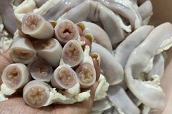 'Lòng se điếu' hình thành từ ruột non nhiễm giun sán, nhiễm độc