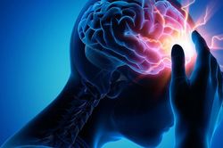 Thiếu máu não thoáng qua có thể là dấu hiệu báo trước nguy cơ đột quỵ
