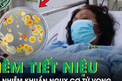 Người phụ nữ sốc nhiễm khuẩn, suy đa cơ quan, nguy cơ tử vong cao sau 3 ngày sốt, ho