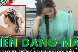 Cô gái 22 tuổi biến dạng mặt vì sai lầm khi gội đầu vào mùa hè