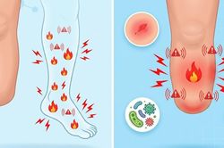 Thời tiết thay đổi c&oacute; thể khiến tay ch&acirc;n đ&atilde; cụt bị đau trở lại