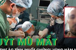Người đàn ông 76 tuổi suýt mù mắt vì ung thư ác tính 'nuốt chửng' vùng hàm mặt