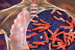 Ho ra máu khi nào cần nhập viện cấp cứu?