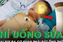 Chỉ uống sữa và gần như không ăn, bé trai 4 tuổi suy đa cơ quan phải đặt ống thở