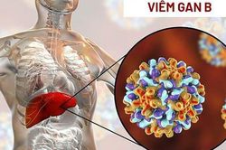 Vi&ecirc;m gan B cần ki&ecirc;ng g&igrave; để ph&ograve;ng biến chứng?