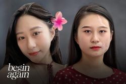 Ước mơ của cô gái xinh đẹp 20 năm bị căn bệnh tàn phá diện mạo