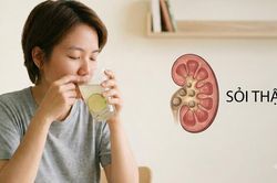 Người bị sỏi thận nên uống nước chanh hằng ngày như thế nào?