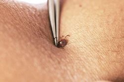 Mỹ: Virus Bourbon được phát hiện ở New York vẫn chưa có thuốc chữa