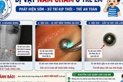 Gắp thành công viên bi nam châm trong dạ dày trẻ hơn 3 tuổi