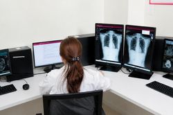 Bộ Y tế đôn đốc khẩn trương phê duyệt giá dịch vụ chẩn đoán hình ảnh sử dụng PACS