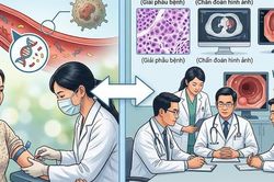 Xét nghiệm ctDNA có quyết định việc hóa trị sau mổ ung thư đại tràng?