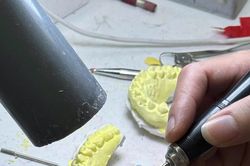 Hà Nội xử phạt, đình chỉ hàng loạt cơ sở sản xuất, kinh doanh răng giả