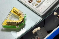 Hà Nội xử phạt 33 cơ sở sản xuất, kinh doanh răng giả vi phạm với tổng tiền 1,35 tỷ đồng