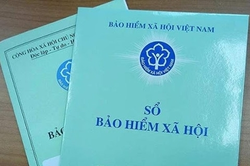 Điều kiện hưởng trợ cấp hưu trí xã hội và mức hưởng trợ cấp hưu trí xã hội