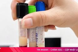 Gan bị tổn thương nặng vì thói quen xấu lặp lại mỗi ngày