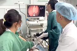 Nuốt phải miếng vỡ th&igrave;a nhựa khi ăn sữa chua, b&eacute; 20 th&aacute;ng tuổi nhập viện cấp cứu