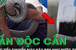 Đang quét sân, người đàn ông bị rắn độc cắn, nước tiểu bất ngờ chuyển màu nâu đen