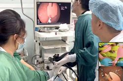 Cắn gãy thìa nhựa khi ăn sữa chua, bé 20 tháng tuổi phải nhập viện cấp cứu