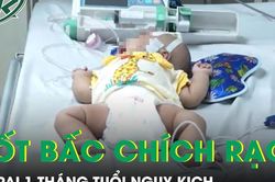 Tin mẹo dân gian, bé trai 1 tháng tuổi nguy kịch sau đốt bấc chích rạch chữa bệnh