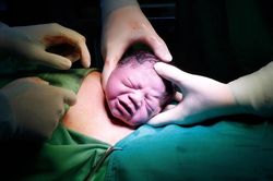 Những lưu ý khi sinh mổ lần hai