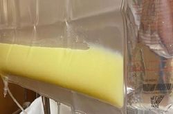 Người đàn ông 36 tuổi 'máu trắng đục như mỡ lợn' vì thường xuyên ăn món ai cũng thích