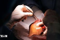 Bỉ tìm ra hướng đi mới trong điều trị ung thư gan di căn