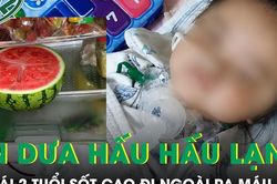 Bé 2 tuổi sốt cao đi ngoài ra máu sau khi ăn dưa hấu để tủ lạnh