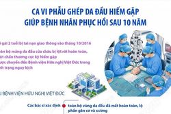 Bé gái hồi phục hoàn toàn sau ca phẫu thuật ghép da đầu hiếm gặp tại Bệnh viện Hữu nghị Việt Đức