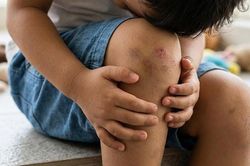 Té ngã, va đập ở học sinh, cách nào phòng tránh hiệu quả?