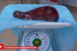 Phẫu thuật cắt lá lách 'khổng lồ' 3,5 kg chèn ép trong ổ bụng