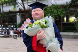Nghị lực của chàng trai bạch tạng tốt nghiệp loại Giỏi ngành Sư phạm Toán