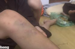 Vụ bạo hành trẻ tại chùa Bầu, Phú Thọ: Nhiều cháu có thương tích