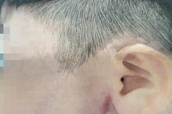 Điều tra vụ bé trai 9 tuổi nghi bị cha ruột bạo hành ở TPHCM