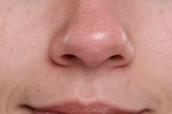 Mụn đầu đen tái đi tái lại dù chăm da kỹ? Nguyên nhân có thể nằm ở những thói quen hằng ngày của bạn