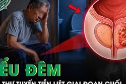 Người đàn ông 65 tuổi bất ngờ phát hiện ung thư tuyến tiền liệt giai đoạn cuối từ dấu hiệu tiểu đêm