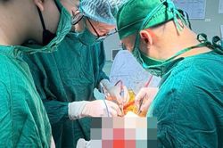Đau đầu kéo dài, cụ bà 73 tuổi phát hiện khối u não lớn