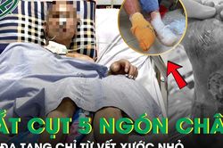 Người đàn ông suy đa tạng, phải cắt cụt 5 ngón chân chỉ từ vết xước nhỏ