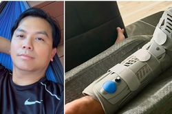 Ca sĩ Mạnh Quỳnh bị vỡ xương mắt cá chân