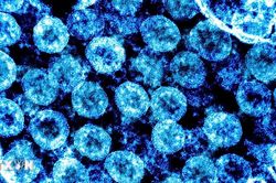 SARS-CoV-2 có thể kích hoạt virus tiềm ẩn, hé lộ cơ chế 'long COVID'
